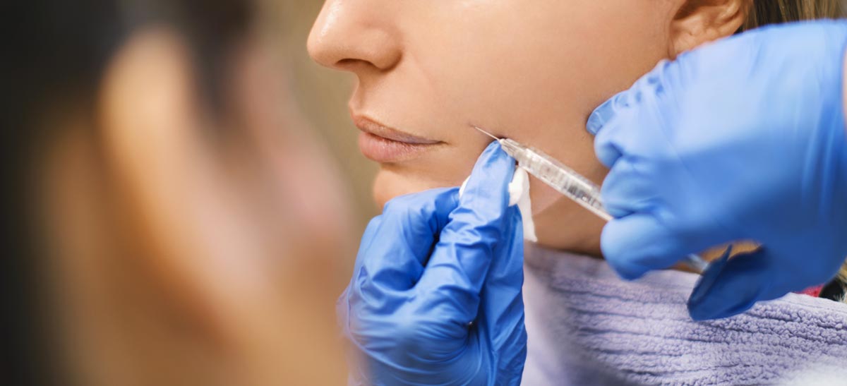 Injections d'acide hyaluronique dans le visage